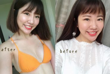 第三次鼻子微整｜自然的玻尿酸鼻子微整，讓我續續保持山根！@捷運雙連站(美麗晶華診所)